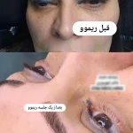 -2147483648_-210328