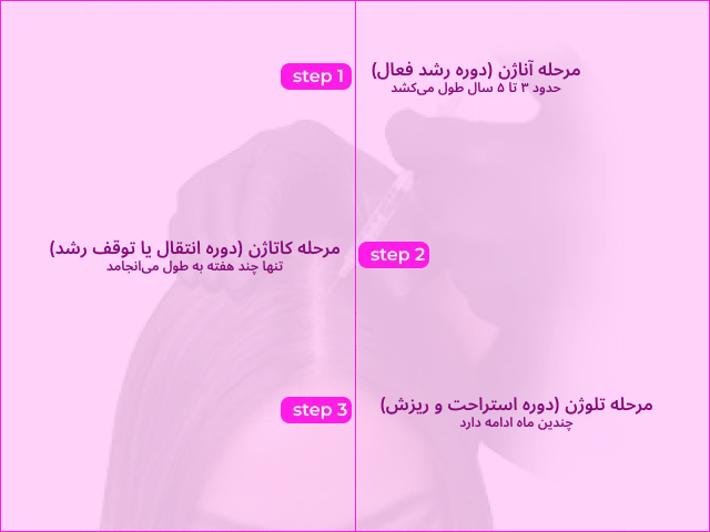 مزوتراپی مو جهت درمان ریزش مو ارثی در کلینیک زیبایی