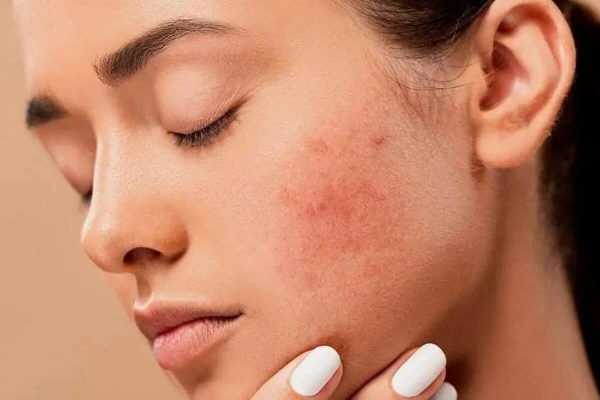 آرایش تخصصی برای پوست حساس