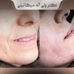 DrMikaeili-nemoonekar-galeb1