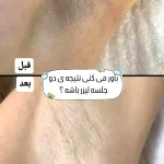Screenshot_۲۰۲۶-۰۵-۰۲-۱۱-۳۱-۲۰-۰۹۵_com.instagram.android