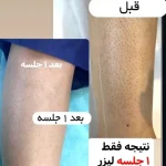 Screenshot_۲۰۲۶-۰۵-۰۲-۱۱-۳۵-۴۳-۱۴۶_com.instagram.android