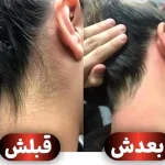 Screenshot_۲۰۲۶-۰۵-۰۲-۱۱-۳۷-۰۴-۱۱۲_com.instagram.android