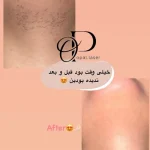 Screenshot_۲۰۲۶-۰۵-۰۲-۱۱-۳۷-۰۸-۲۹۱_com.instagram.android