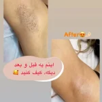 Screenshot_۲۰۲۶-۰۵-۰۲-۱۱-۳۷-۱۶-۰۷۱_com.instagram.android