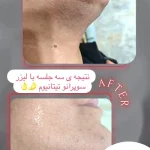 Screenshot_۲۰۲۶-۰۵-۰۲-۱۱-۳۹-۰۶-۲۵۵_com.instagram.android