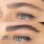 abra10