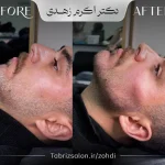 zohdi-13