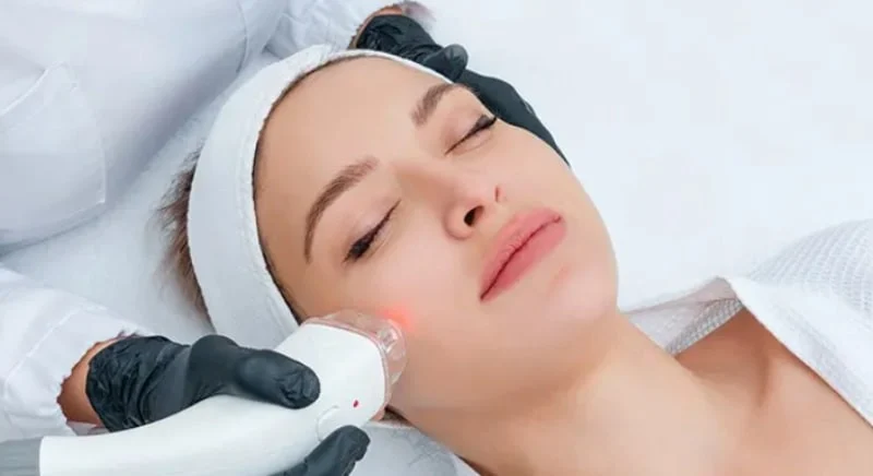 هزینه لیزر اسکار صورت در کلینیک های زیبایی